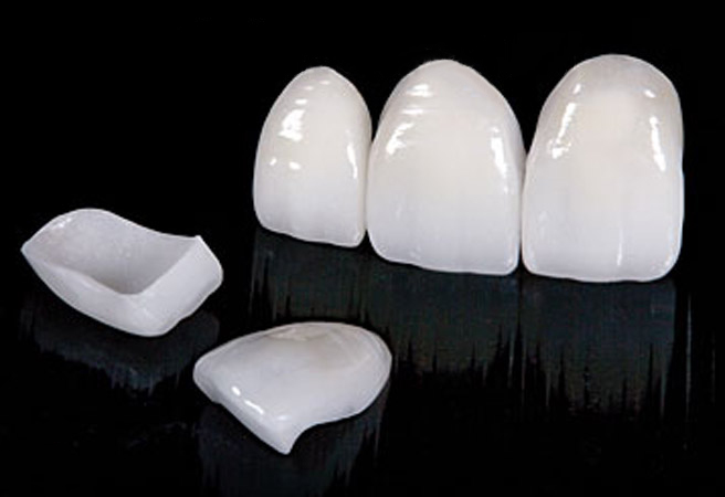 протезирование передних зубов