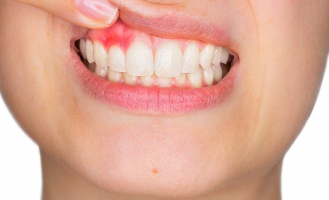 от здоровья десен зависит здоровье зубов